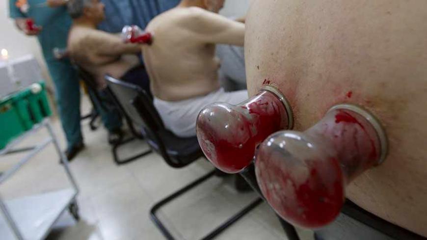 Assem al-Tamimi, a Palestinian doctor and Hijama specialist, treats patients at his clinic in the West Bank city of Hebron August 8, 2009. Hijama is a traditional Islamic treatment method that involves creating a vacuum on the skin by placing inverted cups on parts of the body and drawing blood from an incision on the skin. REUTERS/Nayef Hashlamoun (WEST BANK HEALTH IMAGES OF THE DAY) - RTR26IKP