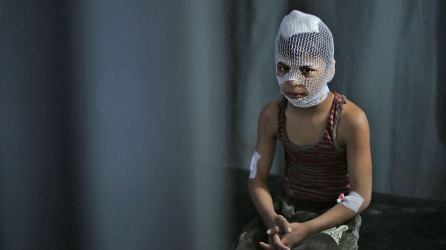 TOPSHOT - EDITORS NOTE: Graphic content / A wounded Syrian child sits at a makeshift clinic in the town of Maaret Misrin following Syrian government forces airstrikes on March 5, 2020 in the country's northwestern Idlib province. - Russian air strikes killed at least 15 civilians including a child in the last major opposition bastion of Idlib in northwestern Syria, a Britain-based war monitor said. (Photo by Aref TAMMAWI / AFP) (Photo by AREF TAMMAWI/AFP via Getty Images)