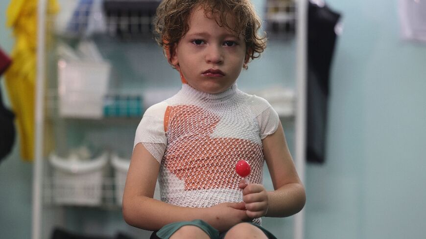More than a third of the burns patients treated at MSF clinics across Gaza were aged under five