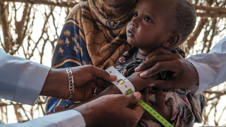 A health worker takes an arm measurement, a benchmark of malnutrition, at a Save the Children mobile clinic near Gode, Ethiopia