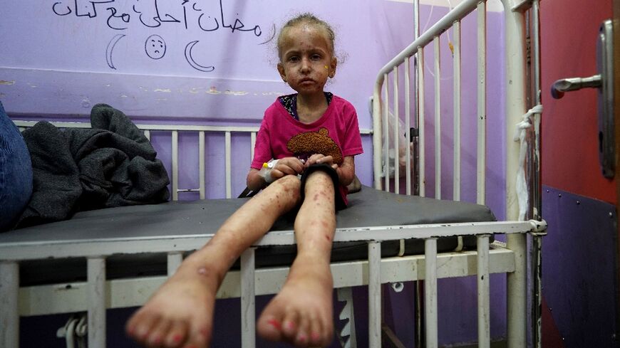 A Palestinian child waits for treatment at Al-Aqsa Martyrs Hospital in Deir al-Balah in the central Gaza Strip on May 30, 2024