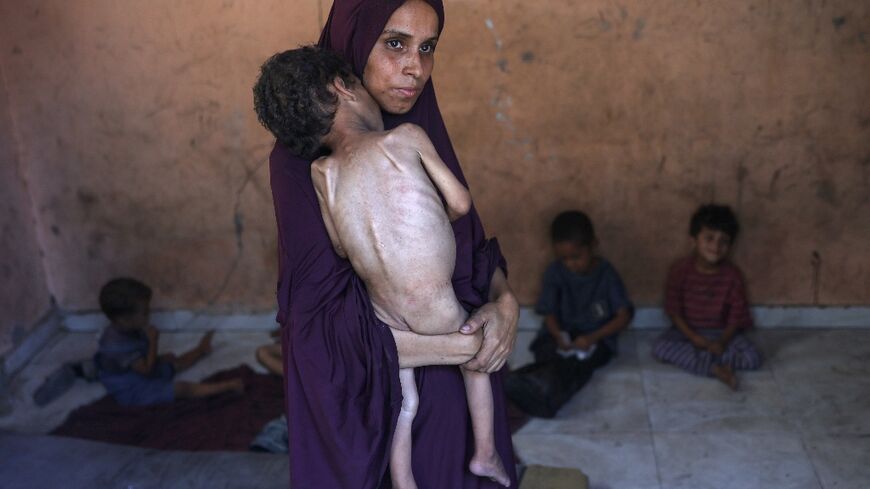 Naeema, a Palestinian mother, carries her malnourished two-year-old son Yazan as they stand in their damaged home in the Al-Shati refugee camp in Gaza City