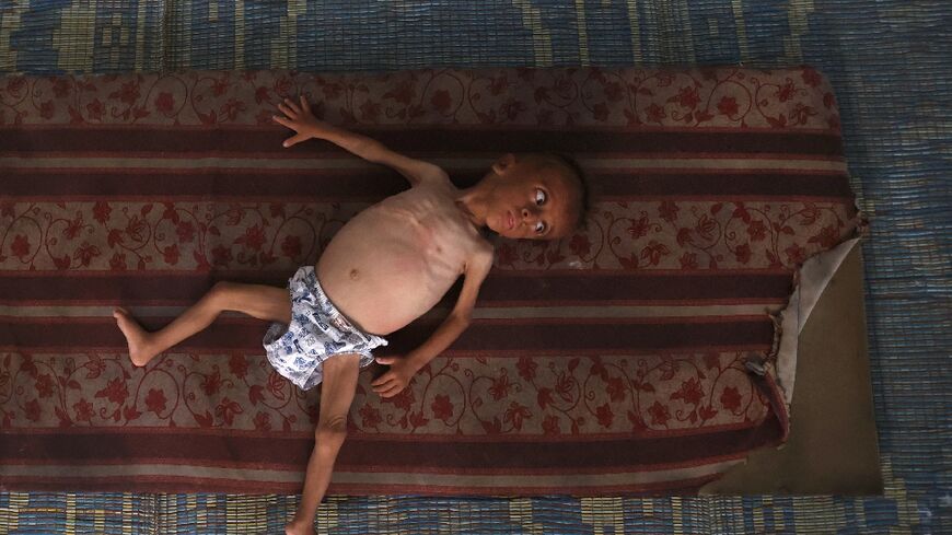 Mohammed al-Mutawaq, an 18-month-old Palestinian boy, inside a tent in the Al-Shati refugee camp west of Gaza City, on July 24, 2025 