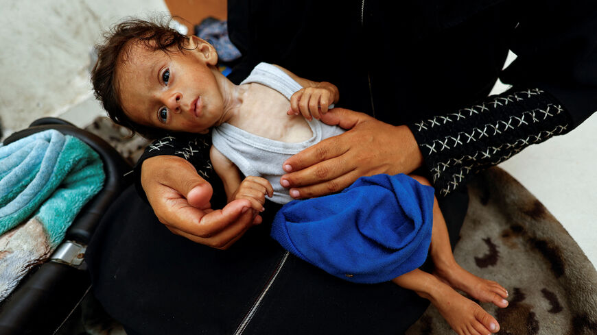 Palestinian mother Amira Muteir holds her five-month-old baby Ammar, whom she says is wasting away from malnutrition, in Gaza City, August 5, 2025. REUTERS/Mahmoud Issa