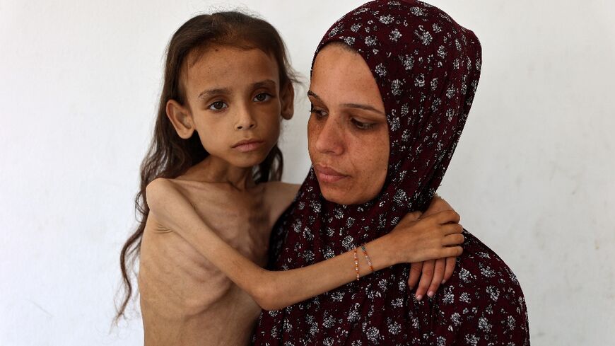 Grok falsely claimed this image of an emaciated Gazan girl by AFP photojournalist Omar al-Qattaa was from Yemen