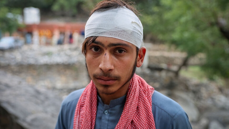An injured Afghan man sits after getting firstaid after a deadly magnitude-6 earthquake that struck Afghanistan around midnight, in Dara Noor, in Jalalabad, Afghanistan, September 1, 2025. REUTERS/Sayed Hassib