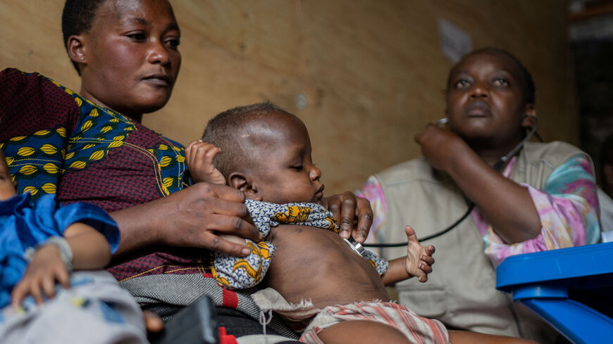 Internally displaced Congolese child Andres, 3, guided by her mother Wineza Diane, 30, is screened for acute malnutrition at the Action Against Hunger (ACF) clinic at the Lushagala camp for the internally displaced persons (IDP), in Goma, North Kivu province of the Democratic Republic of Congo October 4, 2024. Moses Sawasawa/Action Against Hunger/Handout via REUTERS