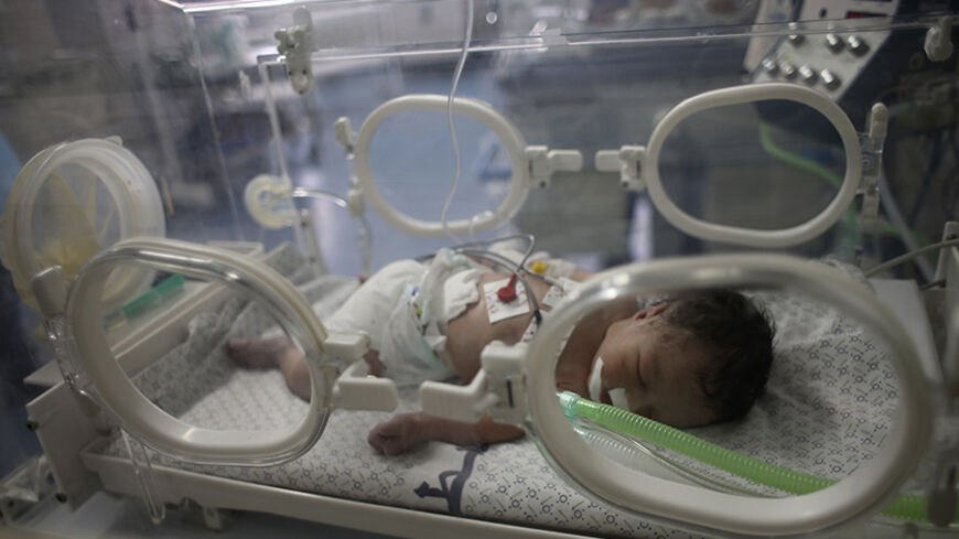 Palestinian baby girl Shayma Shiekh al-Eid lies in an incubator after doctors delivered her from the womb of her mother, whom medics said was killed in an Israeli air strike, at a hospital in Khan Younis in the southern Gaza Strip July 27, 2014.  REUTERS/Ibraheem Abu Mustafa (GAZA - Tags: POLITICS CIVIL UNREST HEALTH TPX IMAGES OF THE DAY) - RTR409X4
