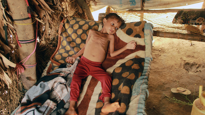 Yemeni 8-year-old displaced girl child, Samar Ali Ahmed, weighing nine and a half kilograms suffering from acute malnutrition, is pictured in Hajjah Governorate, in northern Yemen, on September 23, 2020. - The girl, who lives with her family in Abs camp, was unable to go to hospital for treatment due to poverty. (Photo by ESSA AHMED / AFP) (Photo by ESSA AHMED/AFP via Getty Images)