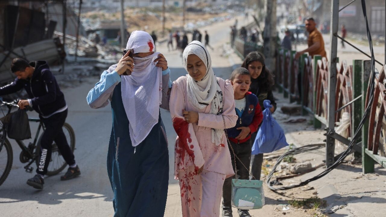 A family accompanies an injured Palestinian girl following Israeli bombardment on the Firas market area of Gaza City 