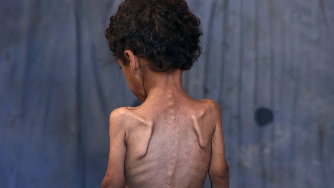 Aid and human rights groups warn 'mass starvation' is spreading in Gaza