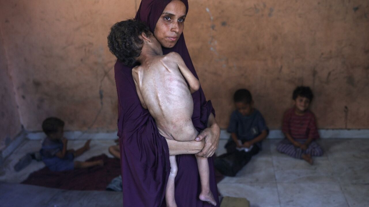 Naeema, a Palestinian mother, carries her malnourished two-year-old son Yazan as they stand in their damaged home in the Al-Shati refugee camp in Gaza City