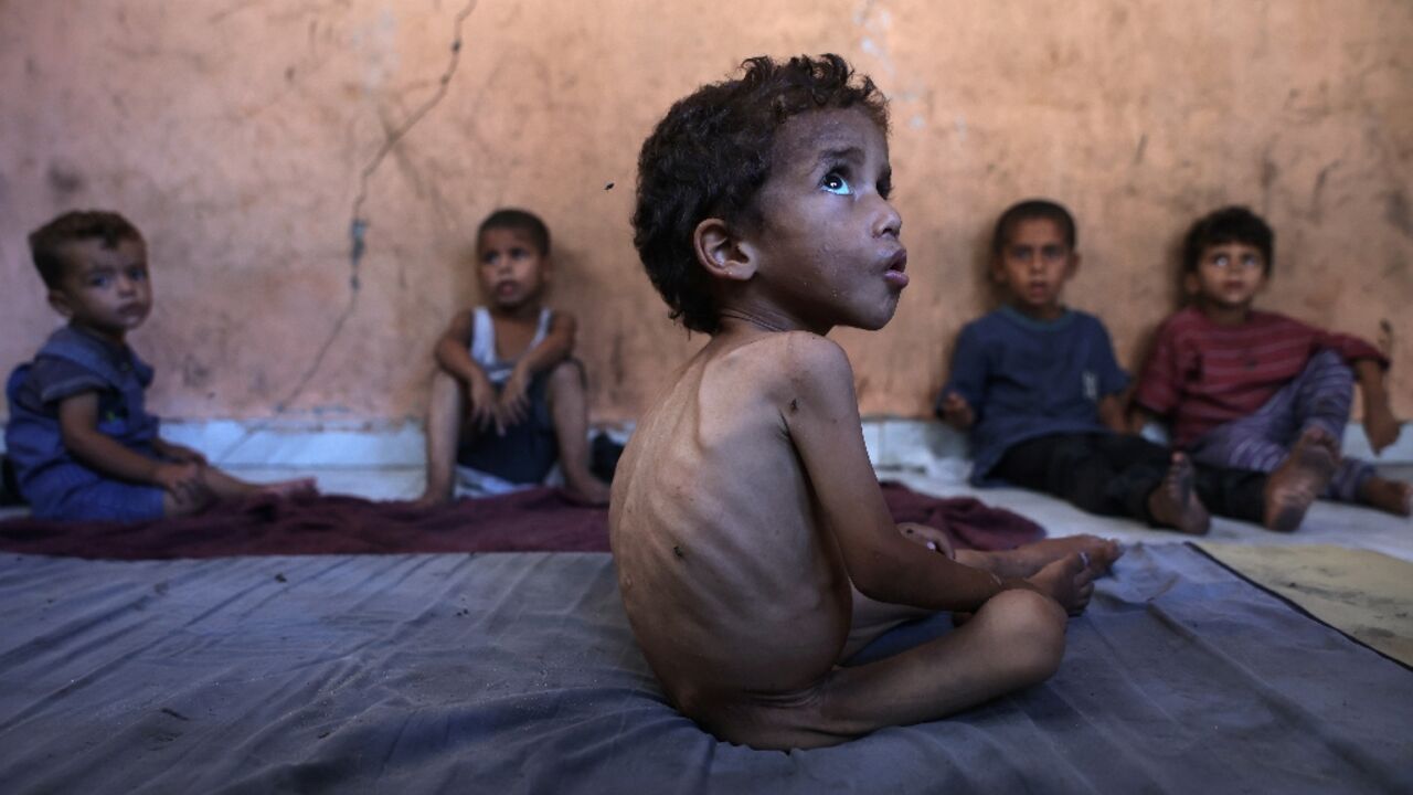 Gaza is suffering 'man-made... mass starvation', according to the head of the World Health Organization, Tedros Adhanom Ghebreyesus