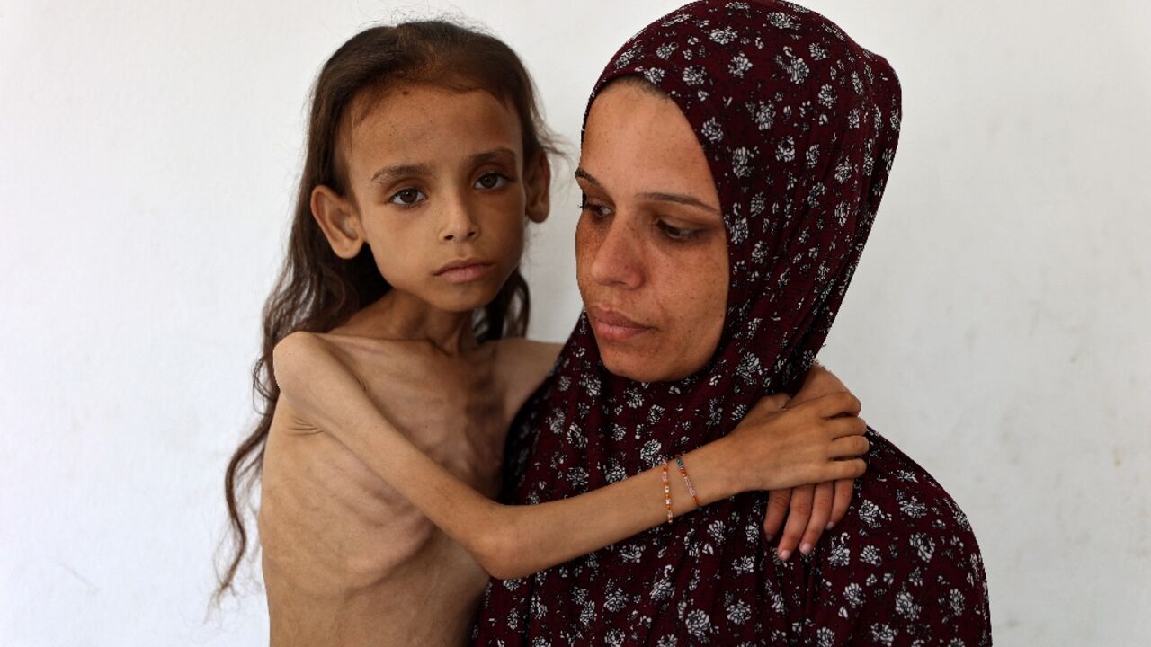Grok falsely claimed this image of an emaciated Gazan girl by AFP photojournalist Omar al-Qattaa was from Yemen