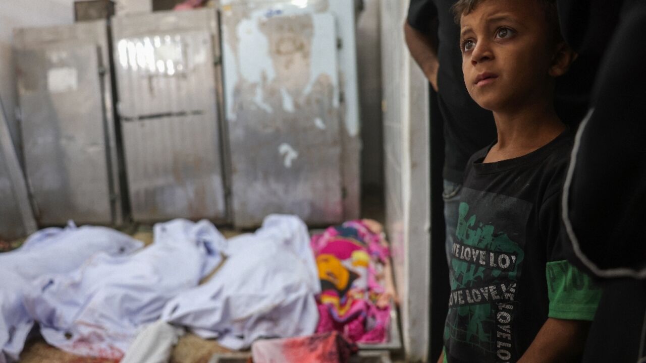 A boy stands near bodies at a hospital in Gaza. Two foreign doctors have described seeing horrific scenes working in Gaza, saying children were suffering the most