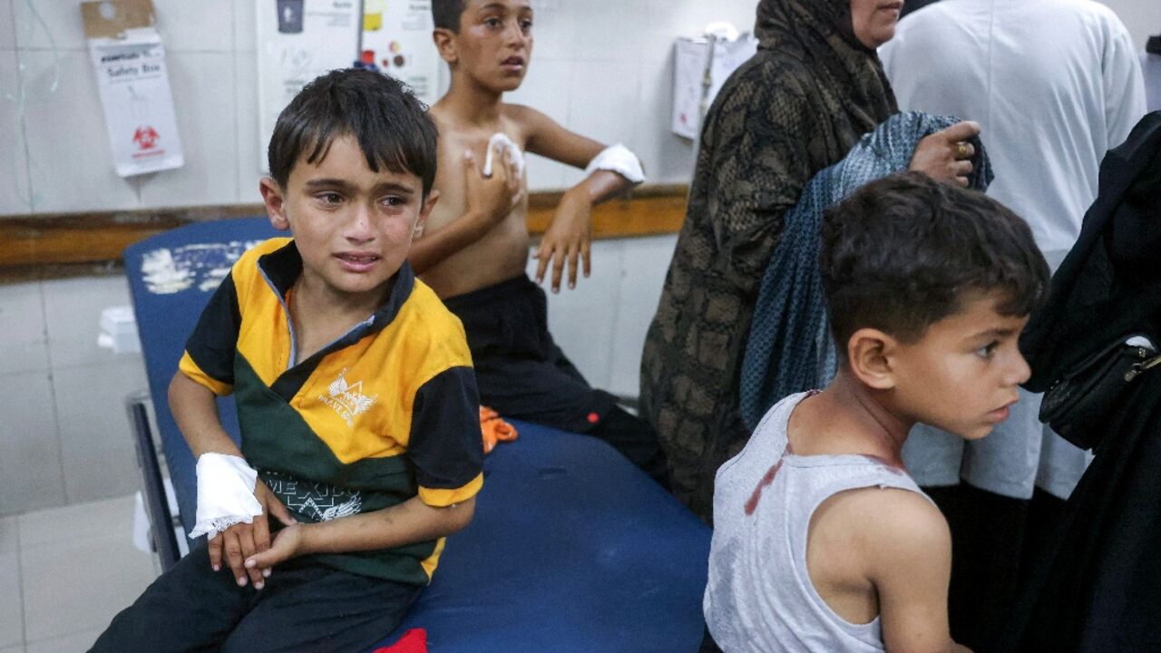 Palestinian children wounded by Israeli strikes wait for medical care in Gaza's Nasser Medical Complex