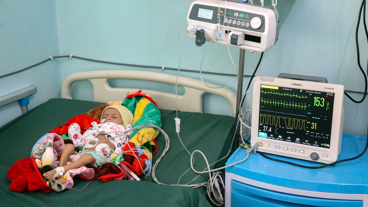 A Yemeni child suffering from malnutrition receives at a treatment centre in the country's third-city of Taez, on October 28, 2020. (Photo by AHMAD AL-BASHA / AFP) (Photo by AHMAD AL-BASHA/AFP via Getty Images)