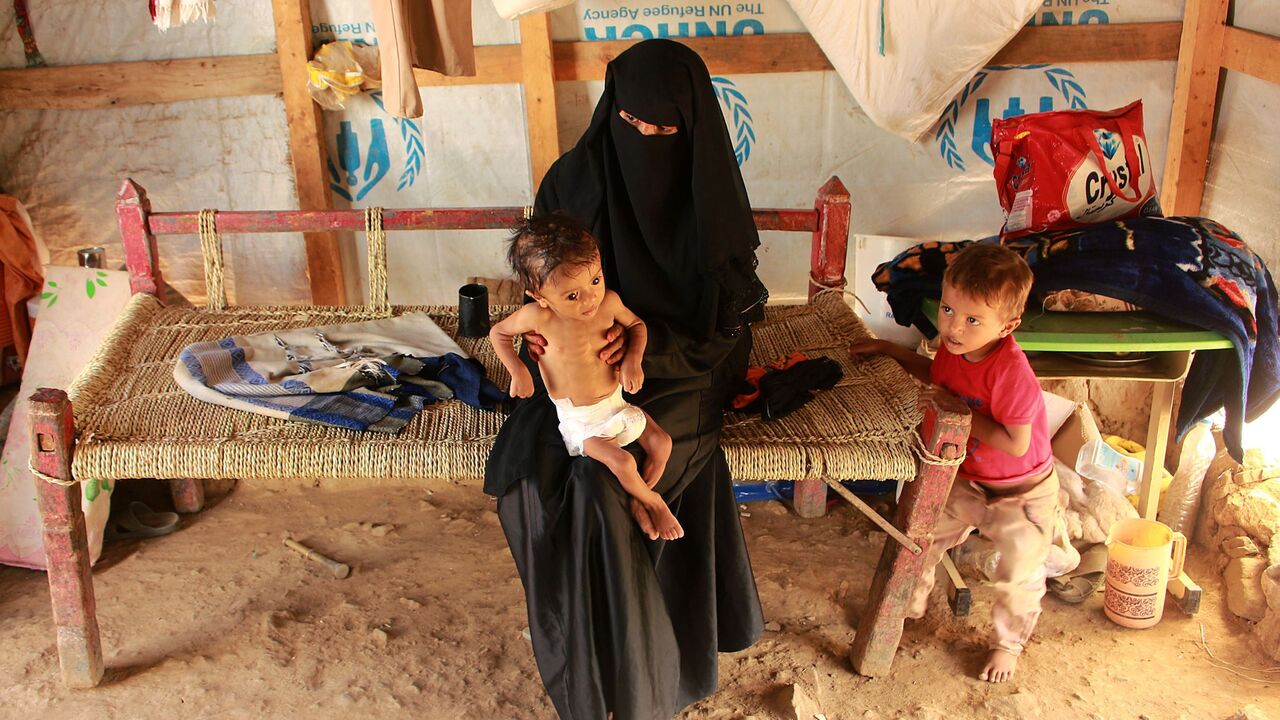 Hashem Mahmoud Atin, a ten-month-old displaced Yemeni child suffering from acute malnutrition and who is unable to reach a hospital for treatment, is held by his mother at a camp in Abs in northern Yemen's Hajjah province on September 3, 2020. - Hundreds of children and pregnant women have been negatively affected by the closure of medical clinics funded by the United Nations Children's Fund (UNICEF) in Yemen's displaced camps. (Photo by ESSA AHMED / AFP) (Photo by ESSA AHMED/AFP via Getty Images)