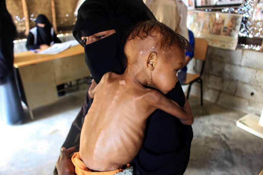 A Yemeni toddler suffering from severe malnutrition is held by her mother as she awaits treatment at a medical facility in northwestern Hajjah province late last year