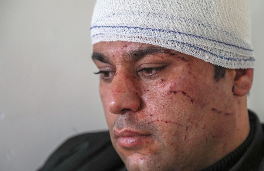 Iraqi taxi driver Ziryan Wazir said the windows of his car exploded and he was injured in the face