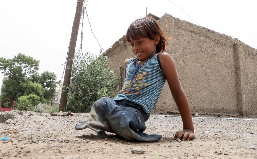 A Yemeni child whose legs were amputated after a landmine injury plays in the city of Aden on August 9, 2018 during a trip in Yemen organised by the UAE's National Media Council 