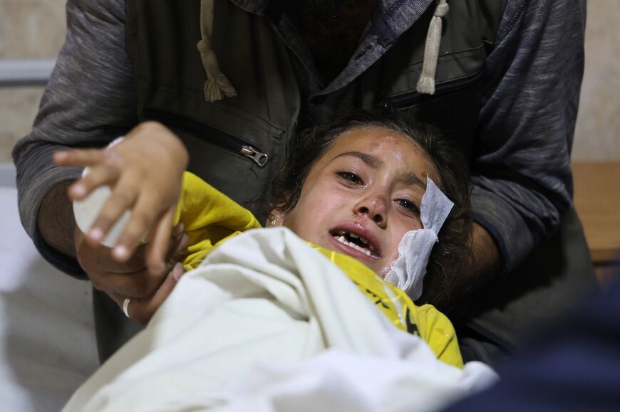 A Syrian girl receives treatment in the rebel-held city of Idlib following bombardment by Syrian forces