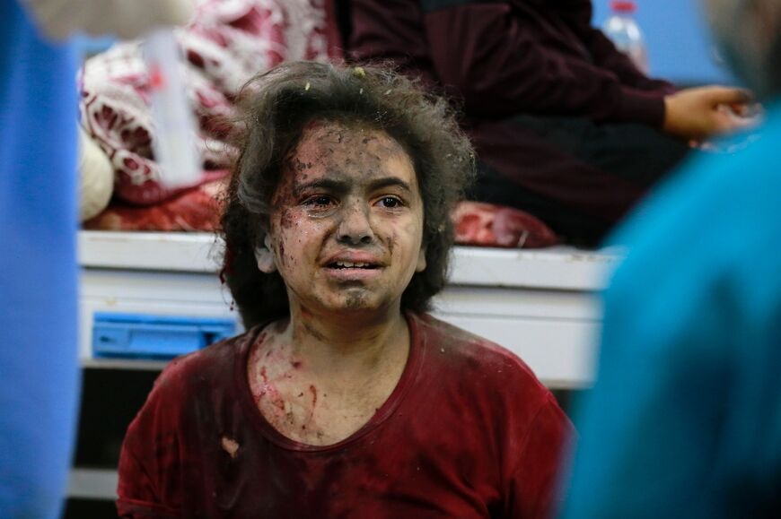 A young injured girl awaits treatment at the emergency ward of the Al-Shifa hospital following an Israeli strike, in Gaza City on November 5, 2023