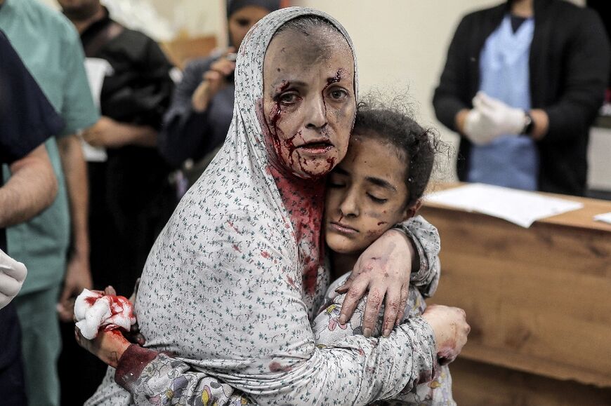 A Palestinian woman wounded in bombardment hugs an injured girl child in Gaza