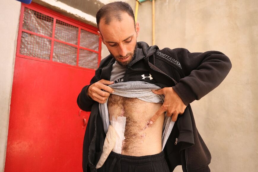 Zakaria al-Adra shows the scars left after an Israeli settler shot him at point-blank range on October 13