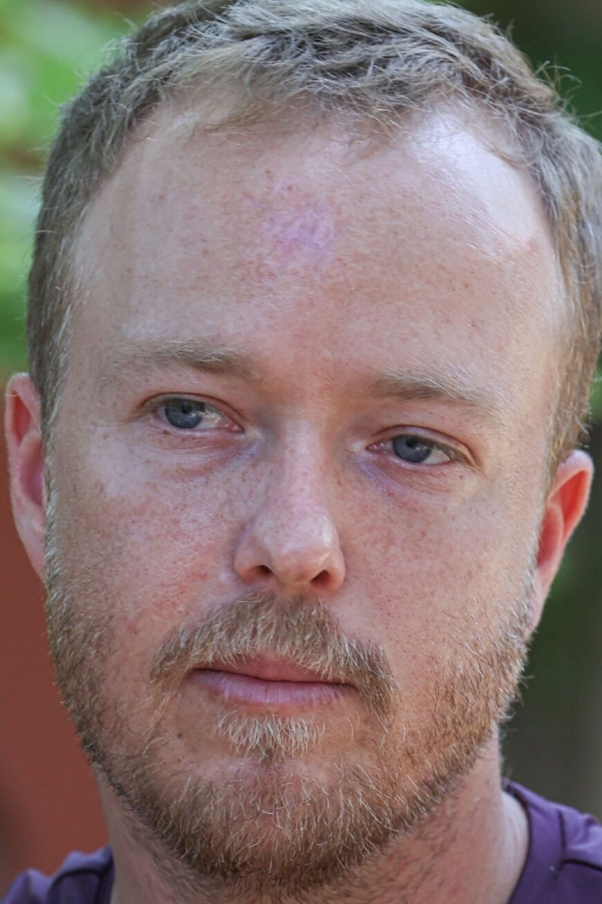 Saar Ram, an Israeli reservist who led a tank unit in Gaza, had his skull broken when Palestinian fighters sprang out of tunnels to ambush his unit