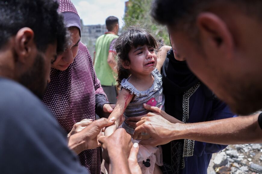 Palestinians tend to a girl wounded in an Israeli strike in the Saftawi neighbourhood west of Jabalia in the northern Gaza Strip
