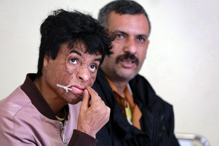 Mohammed Zakaria, 16, had dreamt of becoming a professional footballer before an air strike in his native Yemen left him with extensive burns.