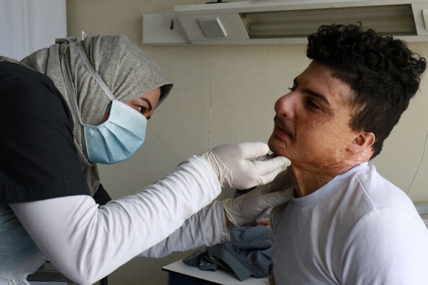 Hossam Abd al-Rahman, 21, is waiting for his ninth operation at the hospital to treat third-degree burns to his face, neck, abdomen, back and hand. He had already undergone 17 surgeries in his native Iraq. 