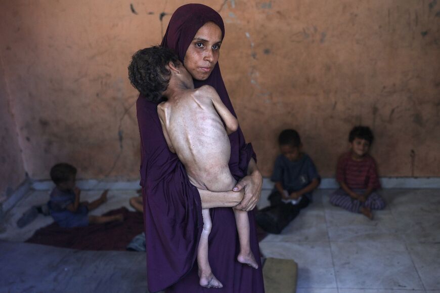 Naeema, a Palestinian mother, carries her malnourished two-year-old son Yazan as they stand in their damaged home in the Al-Shati refugee camp in Gaza City