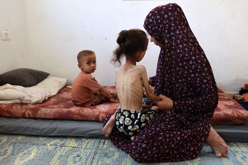 Nine-year-old malnourished Palestinian girl Mariam Dawwas with her mother in Gaza City