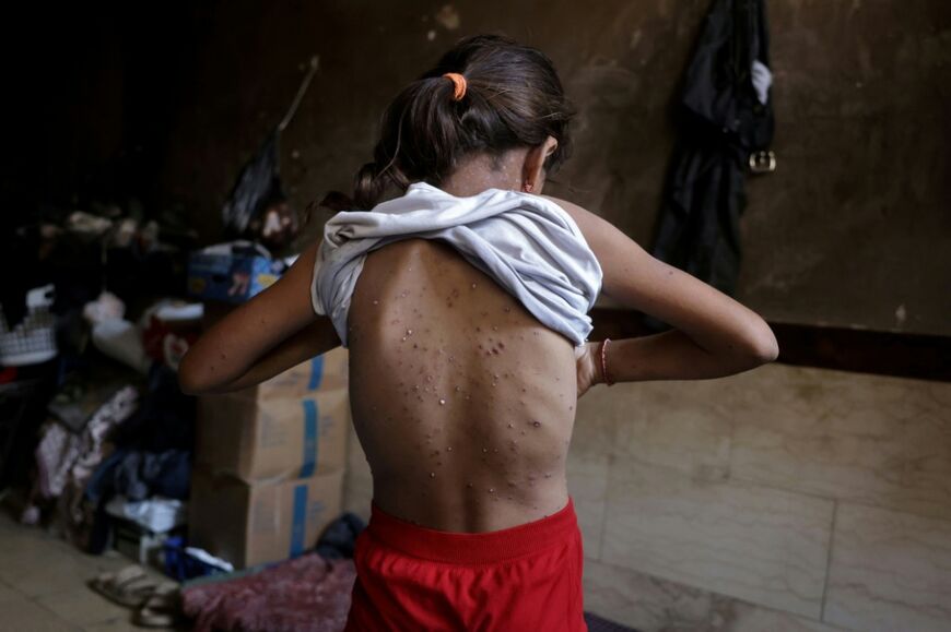 International aid organisations have repeatedly warned that medical supplies in Gaza remain grossly inadequate